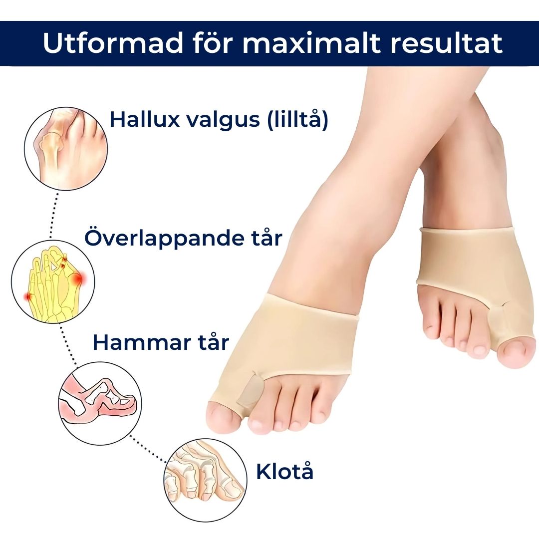 FotBalans Hallux Valgus Tåseparator | Justerar Stortån och Lindrar Smärta – Icke-Invasiv Lösning vid Hallux Valgus