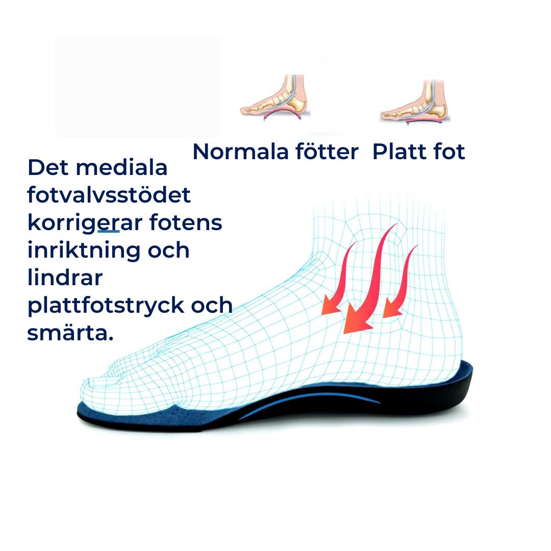 OrthoAlign Pronationsstöd | Inlägg för Fotjustering och Bågavlastning - Ortopediska Skoinlägg för Korrigering av Överpronation