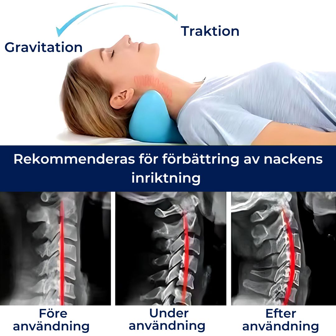 NeckAlign Kiropraktisk Nackkudde | Nacksträckare - Smärtlindring - Förbättrad Hållning - Bättre Sömn
