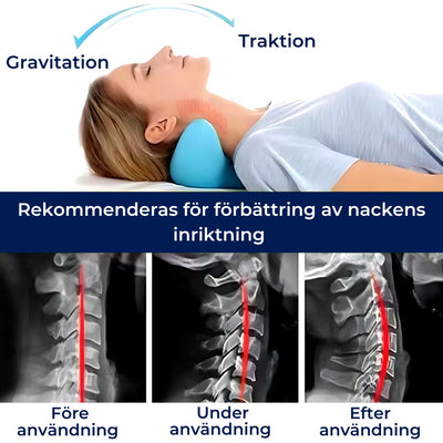 NeckAlign Kiropraktisk Nackkudde | Nacksträckare - Smärtlindring - Förbättrad Hållning - Bättre Sömn